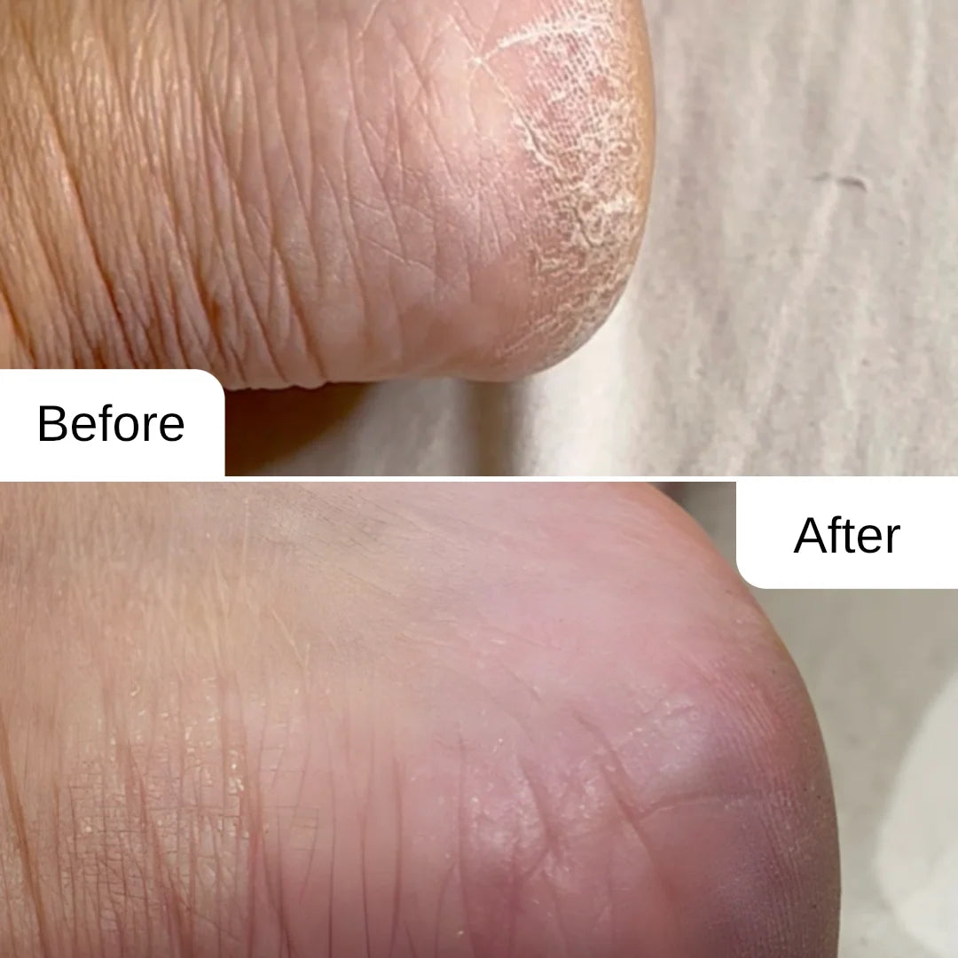 Repairing and Nourishing Foot Cream