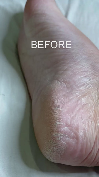 Repairing and Nourishing Foot Cream